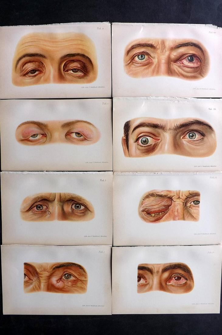 Haab, Otto 1901 Lot of 8 Medical Prints. Eye Diseases (1 of 2)