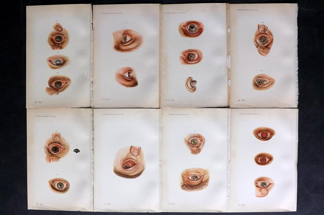 Haab, Otto 1901 Lot of 8 Medical Prints. Eye Diseases (1 of 2)