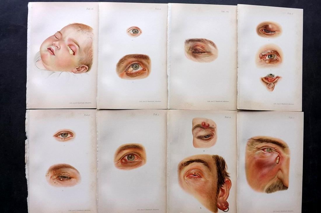 Haab, Otto 1901 Lot of 8 Medical Prints. Eye Diseases (1 of 2)