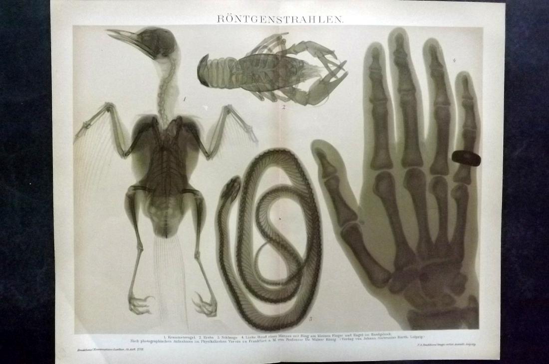 Brockhaus (Pub) 1898 Medical Print. X-Ray (1 of 2)