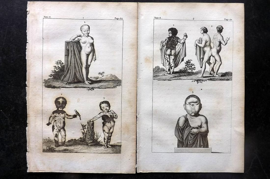 Buffon, Comte de 1825 Pair of Medical Prints. Conjoined Twins, Skin Diseases: Copper Plate Published 1825, Paris for "Oeuvres Completes De Buffon" by the Comte de Buffon and Bernard Lacepede. Paper Size: 8 x 5 inch (20 x 13cm) Minor toning, otherwise Good Condition