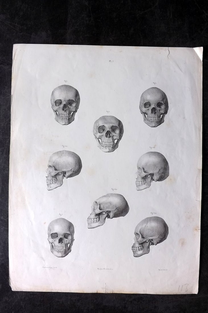 Fau, Dr. Julian 1849 Folio Anatomy Print. Skulls 01 (1 of 2)