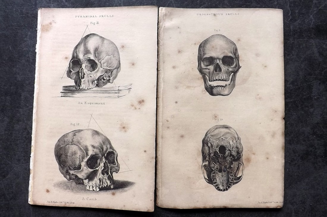 Prichard, James 1844 Pair of Ethnic Anatomy Prints. Carib Esquimaux etc Skulls (1 of 2)
