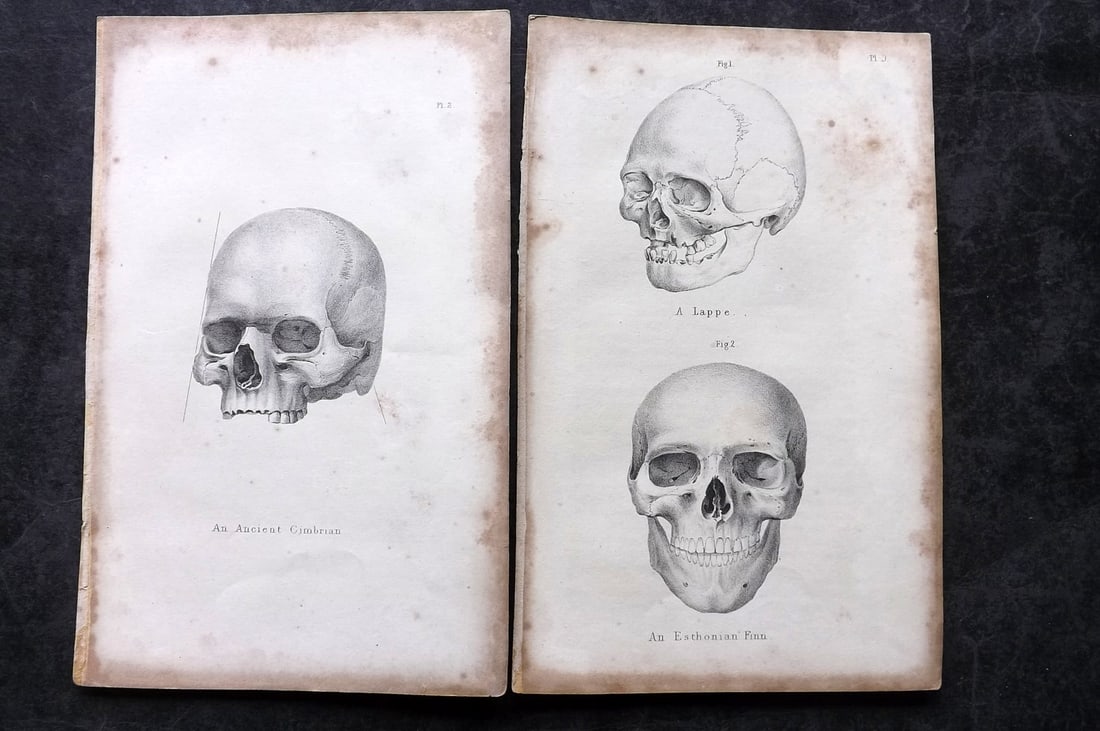 Prichard, James 1844 Pair of Ethnic Anatomy Prints. Estonian Finn, Lap,Cimbrian Skulls: Lithographs Published 1844, London for "Researches Into The Physical History Of Mankind" by James Cowles Prichard. Paper Size: 8.5 x 5.5 inch (22 x 14cm) Heavy tone spotting present.