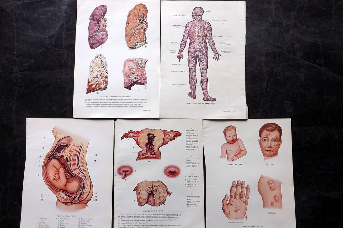 Virtue (Pub) C1940 Lot of 5 Anatomy/Medical Prints (1 of 2)
