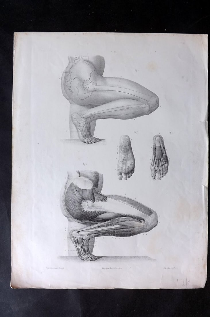 Fau, Dr. Julian 1849 Folio Anatomy Print. View of Leg & Hips 22: Folio Lithograph Published 1849, London for "The Anatomy of the External Forms of Man" by Dr. Julian Fau. Lithographed by Leveille. Edited by Robert Knox. Paper Size: 14 x 10 inch (36 x 25cm) Minor to