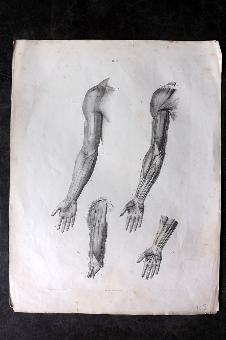 Fau, Dr. Julian 1849 Folio Anatomy Print. Arms 13: Folio Lithograph Published 1849, London for "The Anatomy of the External Forms of Man" by Dr. Julian Fau. Lithographed by Leveille. Edited by Robert Knox. Paper Size: 14 x 10 inch (36 x 25cm) Minor to