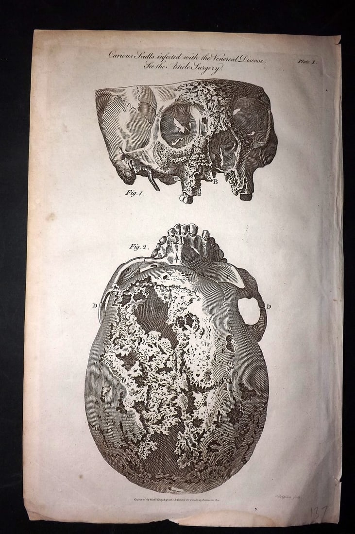 Hall, William 1791 Folio Anatomy Print. Skull (1 of 2)