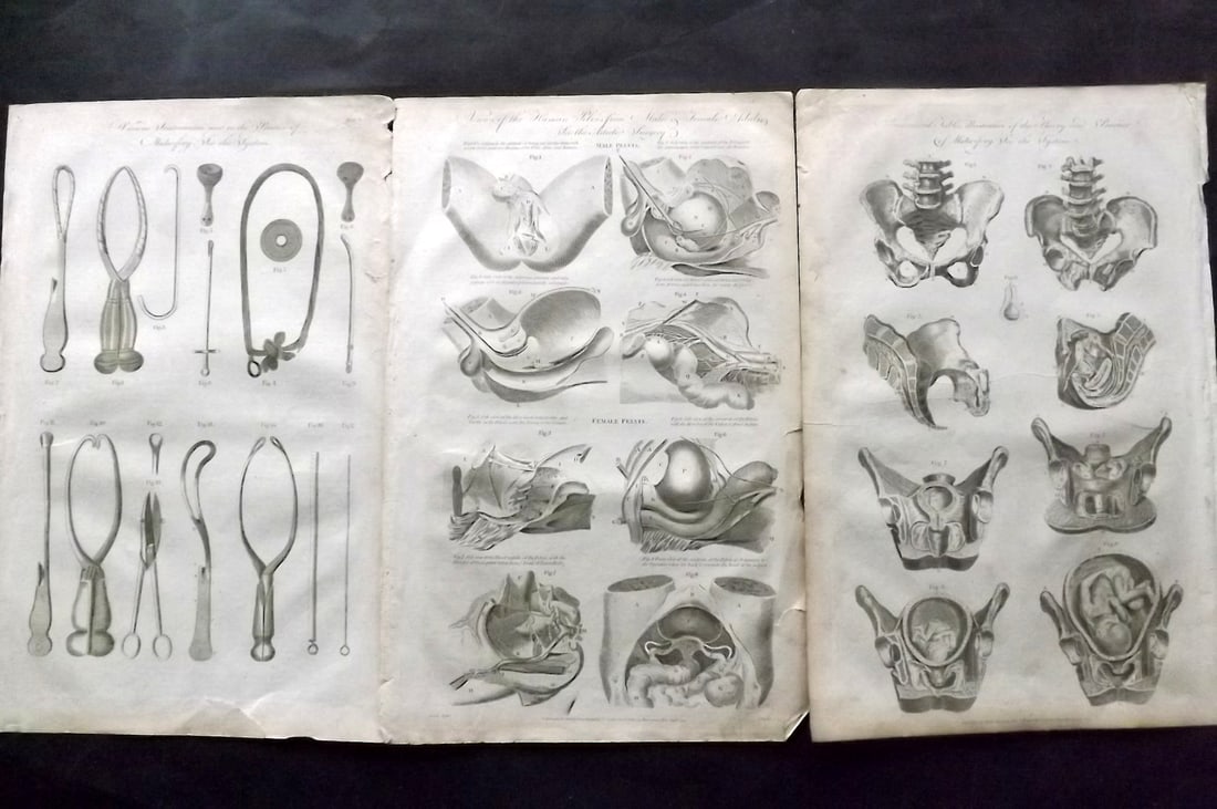 Hall, William 1791 Lot of 3 Folio Anatomy/Medical Prints: Folio Copper Plate Published 1789-91 by C. Cooke, London for "The New Royal Encyclopedia, Or, Complete Modern Universal Dictionary of Arts and Sciences..." by William Henry Hall. Paper Size: 14.5 x 9.