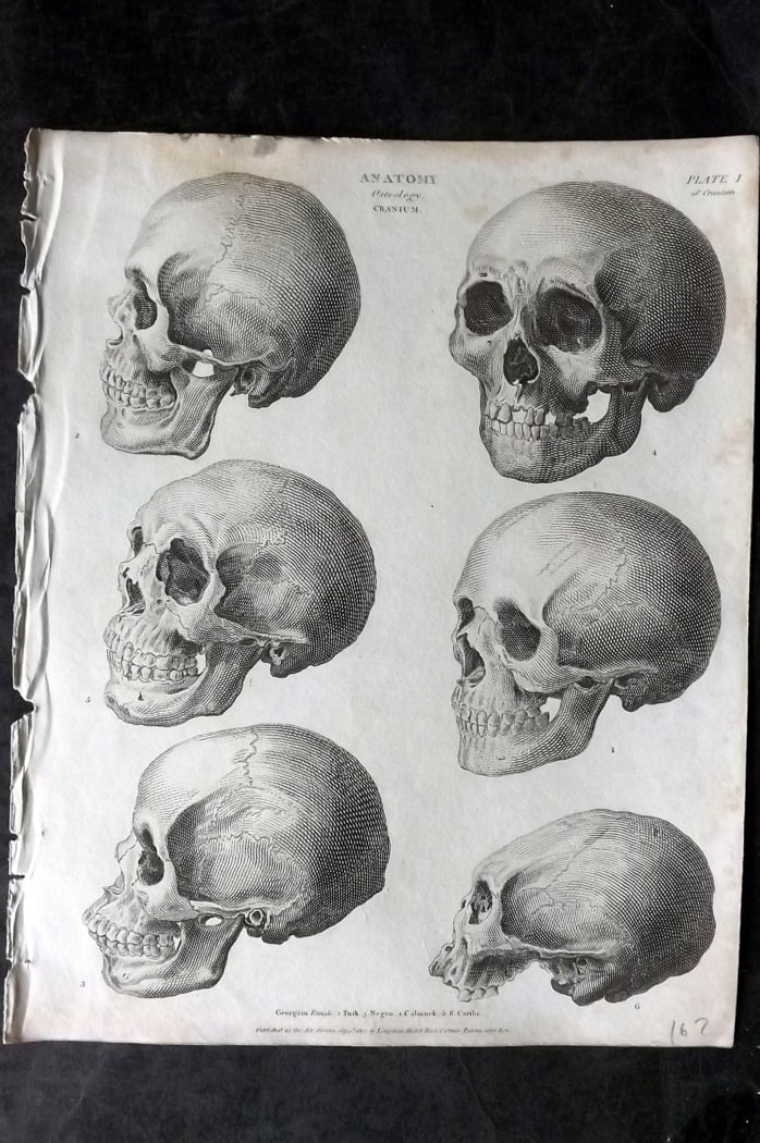 Rees, Abraham 1820 Anatomy Print. Osteology Cranium Skulls 01 (1 of 1)