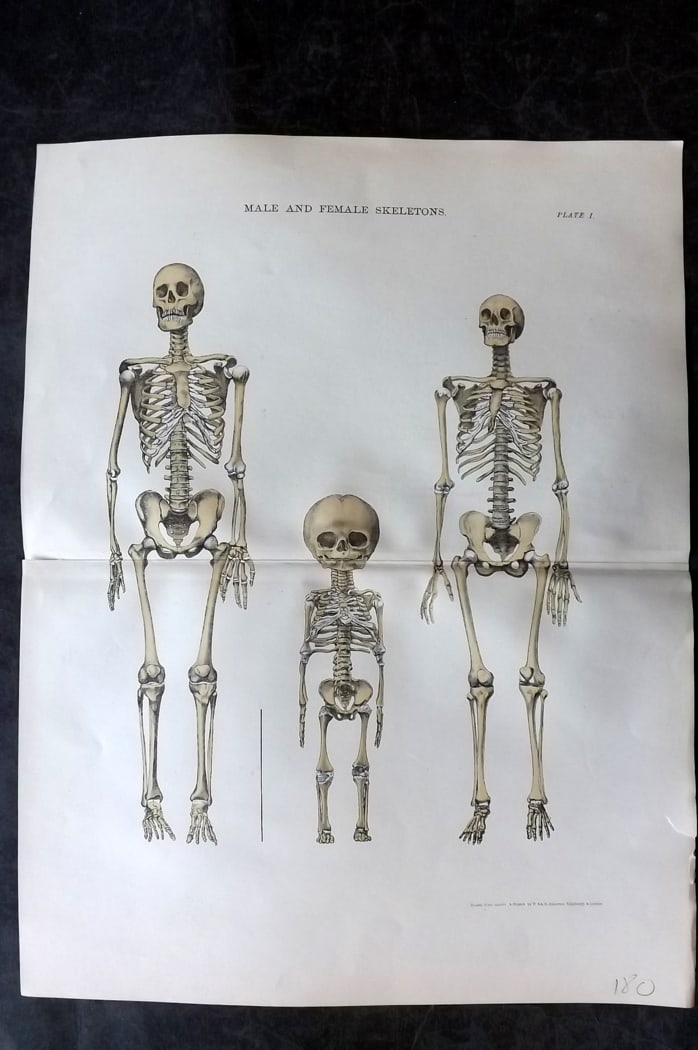 Cathcart & Caird 1885 Anatomy Print. Male & Female Skeletons 01 (1 of 1)