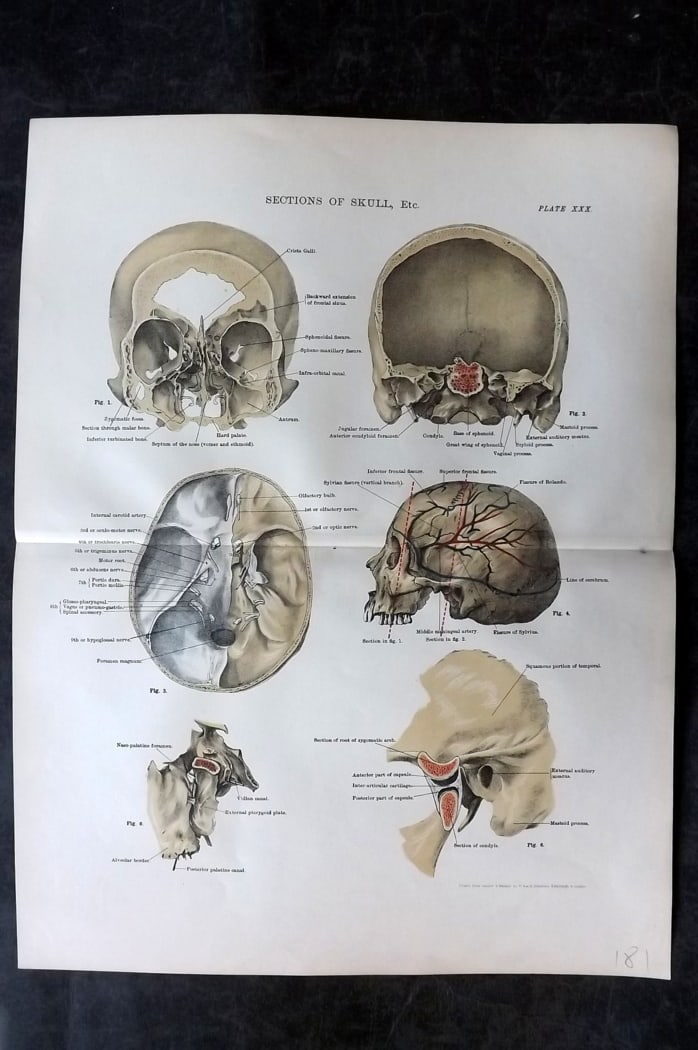Cathcart & Caird 1885 Anatomy Print. Sections of Skull 30 (1 of 1)