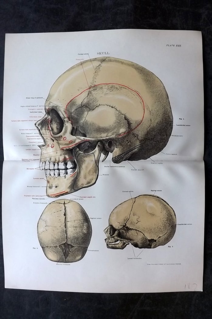 Cathcart & Caird 1885 Anatomy Print. Skull 21 (1 of 1)