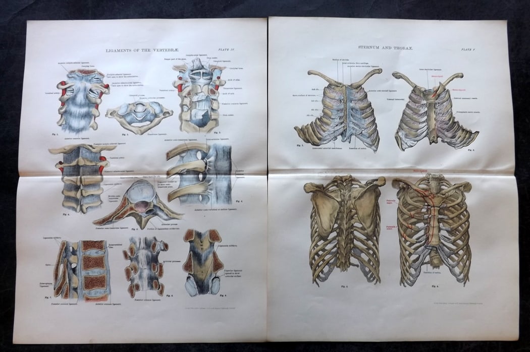 Cathcart & Caird 1885 Pair of Anatomy Prints: Chromolithographs Published 1885 by W. & A. K. Johnston, London for "Johnston's Students' Atlas of Bones and Ligaments" by Charles W. Cathcart & F. M. Caird. Centre fold as published. Paper Size: 14 x