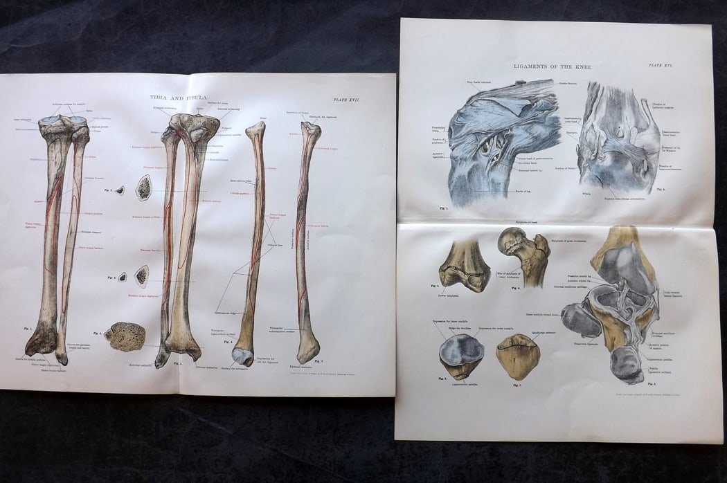 Cathcart & Caird 1885 Pair of Anatomy Prints: Chromolithographs Published 1885 by W. & A. K. Johnston, London for "Johnston's Students' Atlas of Bones and Ligaments" by Charles W. Cathcart & F. M. Caird. Centre fold as published. Paper Size: 14 x