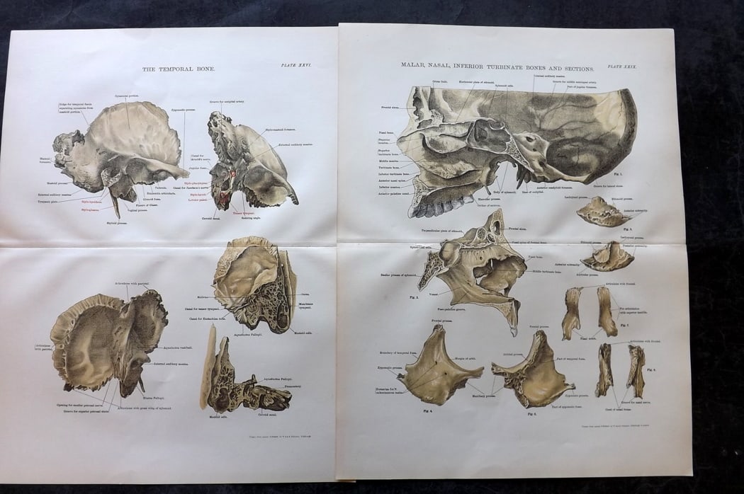 Cathcart & Caird 1885 Pair of Anatomy Prints: Chromolithographs Published 1885 by W. & A. K. Johnston, London for "Johnston's Students' Atlas of Bones and Ligaments" by Charles W. Cathcart & F. M. Caird. Centre fold as published. Paper Size: 14 x