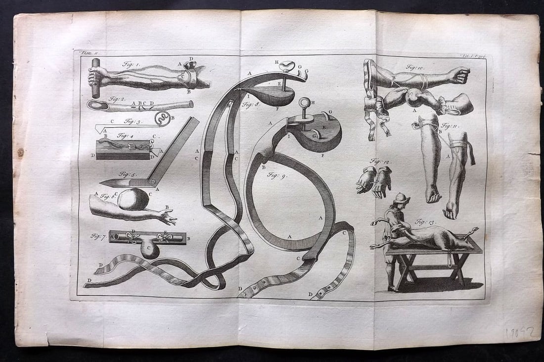 Heister, Lorenz 1743 Folio Medical Print. Surgery 11: Antique Folio Copper Plate Published 1743, London for "A General System of Surgery" by Lorenz Heister. First English Edition. Folds as issued. Rare. Paper Size: 16 x 10 inch (40 x 25cm) Good Condition