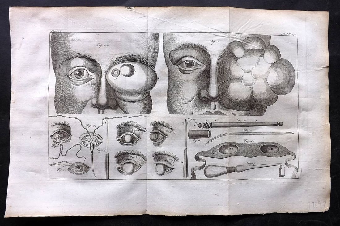 Heister, Lorenz 1743 Folio Medical Print. Surgery 18: Antique Folio Copper Plate Published 1743, London for "A General System of Surgery" by Lorenz Heister. First English Edition. Folds as issued. Rare. Paper Size: 16 x 10 inch (40 x 25cm) Good Condition