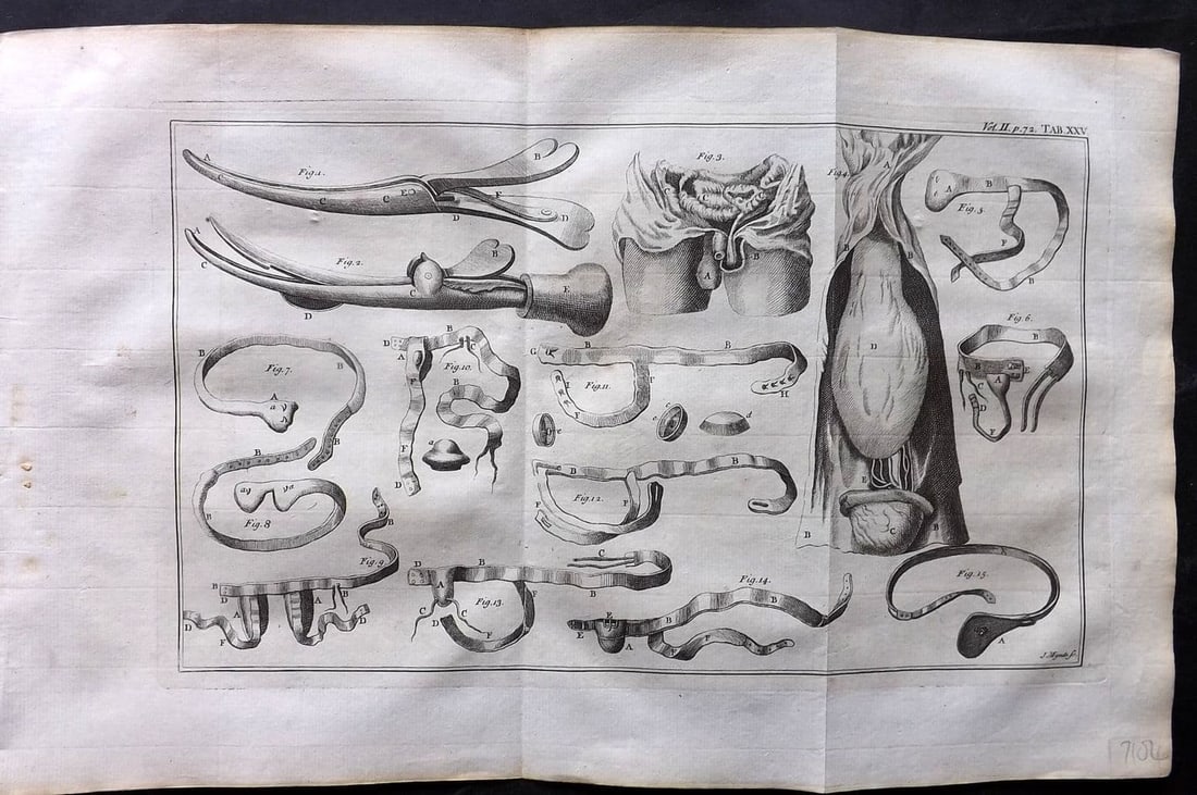 Heister, Lorenz 1743 Folio Medical Print. Surgery 25: Antique Folio Copper Plate Published 1743, London for "A General System of Surgery" by Lorenz Heister. First English Edition. Folds as issued. Rare. Paper Size: 16 x 10 inch (40 x 25cm) Good Condition