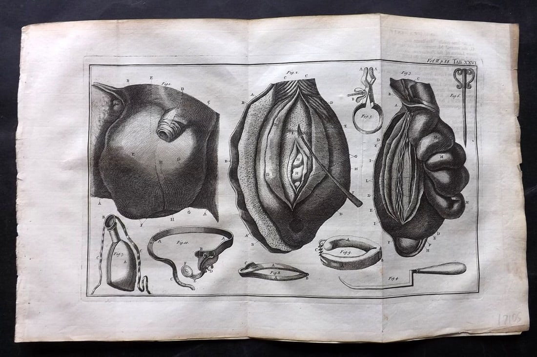 Heister, Lorenz 1743 Folio Medical Print. Surgery 26: Antique Folio Copper Plate Published 1743, London for "A General System of Surgery" by Lorenz Heister. First English Edition. Folds as issued. Rare. Paper Size: 16 x 10 inch (40 x 25cm) Very minor off