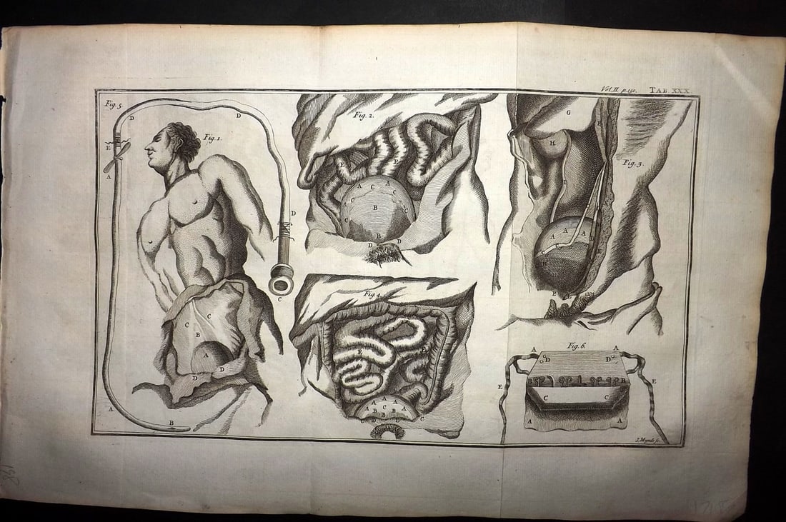 Heister, Lorenz 1743 Folio Medical Print. Surgery 30: Folio Copper Plate Published 1743, London for "A General System of Surgery" by Lorenz Heister. First English Edition. Folds as issued. Rare. Paper Size: 16 x 10 inch (40 x 25cm) Good Condition