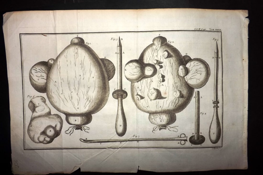 Heister, Lorenz 1743 Folio Medical Print. Surgery 32: Folio Copper Plate Published 1743, London for "A General System of Surgery" by Lorenz Heister. First English Edition. Folds as issued. Rare. Paper Size: 16 x 10 inch (40 x 25cm) Minor wrinkles. A coup