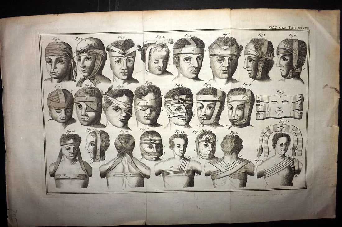 Heister, Lorenz 1743 Folio Medical Print. Surgery 37: Folio Copper Plate Published 1743, London for "A General System of Surgery" by Lorenz Heister. First English Edition. Folds as issued. Rare. Paper Size: 16 x 10 inch (40 x 25cm) Small right marrgin te