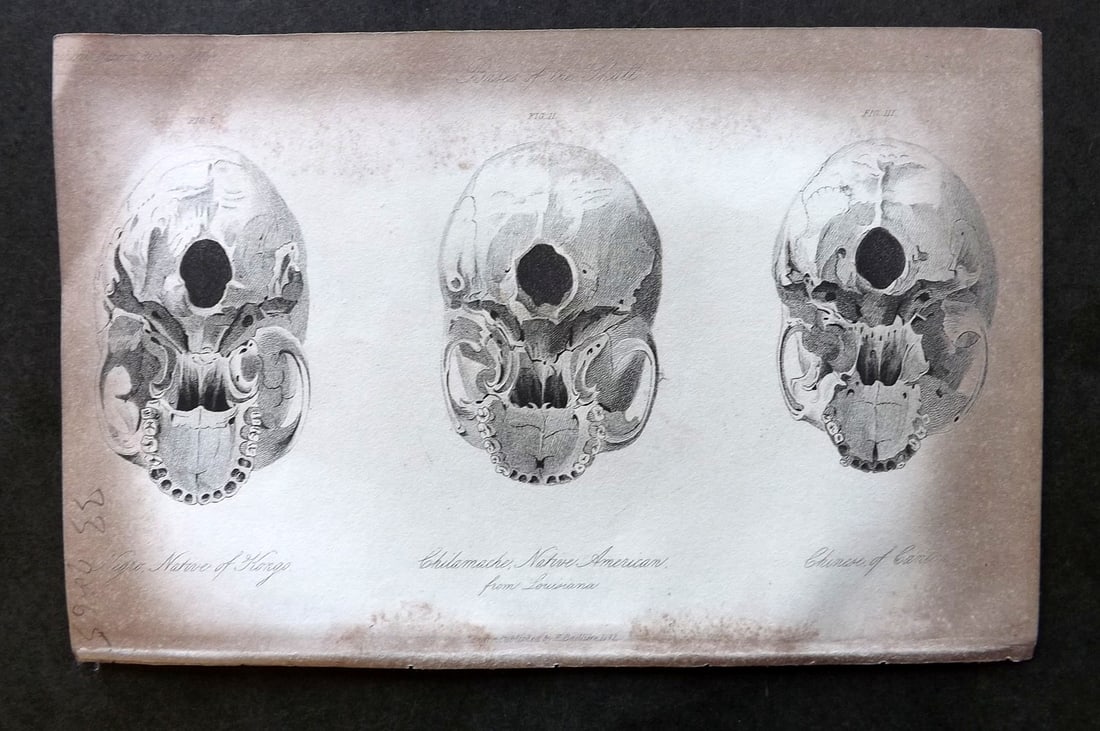 Prichard, James 1848 Skulls from Kongo, American at Louisiana, Chinese of Canton 03 (1 of 1)
