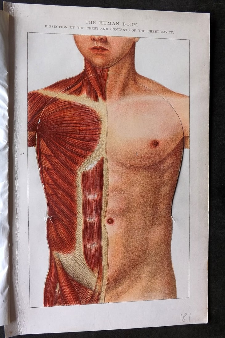Robertson, J. McGregor 1907 Pop Up Anatomy Print. Human Body - Dissection of the Chest: Pop Up Lithograph Published 1907, London for "The Household Physician" by J. McGregor Robertson. Paper Size: 9.5 x 6 inch (24 x 16cm) Good, working Condition