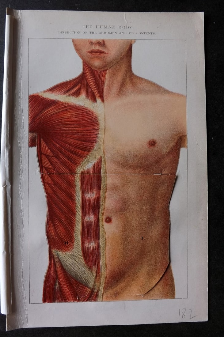Robertson, J. McGregor 1907 Pop Up Anatomy Print. Human Body - Dissection Abdomen and its Contents.: Pop Up Lithograph Published 1907, London for "The Household Physician" by J. McGregor Robertson. Paper Size: 9.5 x 6 inch (24 x 16cm) Good, working Condition