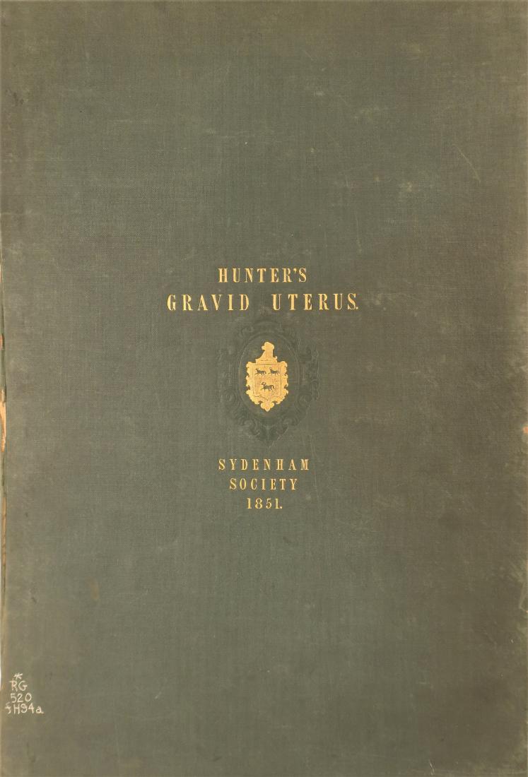 Hunter's Anatomy Plates-Gravid Uterus,1851 (1 of 4)