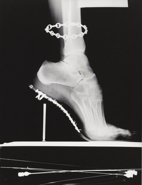 HELMUT NEWTON, X – Ray with chain, Paris, 1994: X – Ray with chain, Paris, 1994 Gelatin silver print. 36.8 x 27.9 cm (14 1/2 x 11 in). Signed, titled, dated in pencil and copyright credit reproduction limitation stamp on the verso. ♠ †