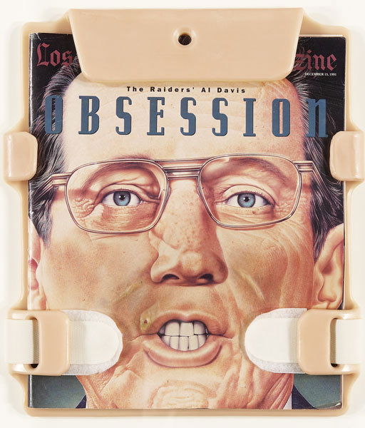 MATTHEW BARNEY b. 1967 Ligator – General Manag: MATTHEWBARNEYb. 1967Ligator – General Managing Partner Hemmoroidal Distractor Oblique Inguinal Hernia – Complete, 1992Vaseli
