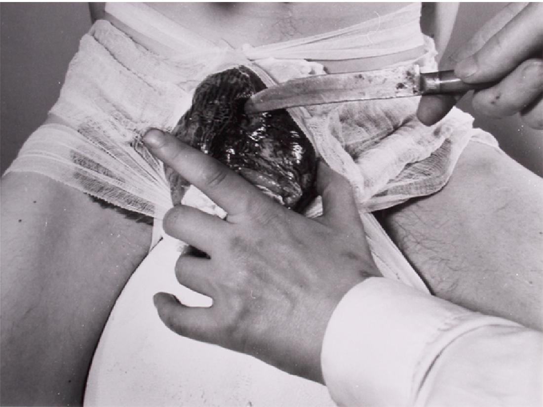 Rudolf Schwarzkogler (1940-1969) Austrian: KNIFE, 1965, gelatin silver print 15 Â½ x 11 Â½â€, mounted to card 25 Â½ x 19 Â½â€, artistâ€™s estate stamp and authorized signature of Edith Adam on verso of card, from the edition