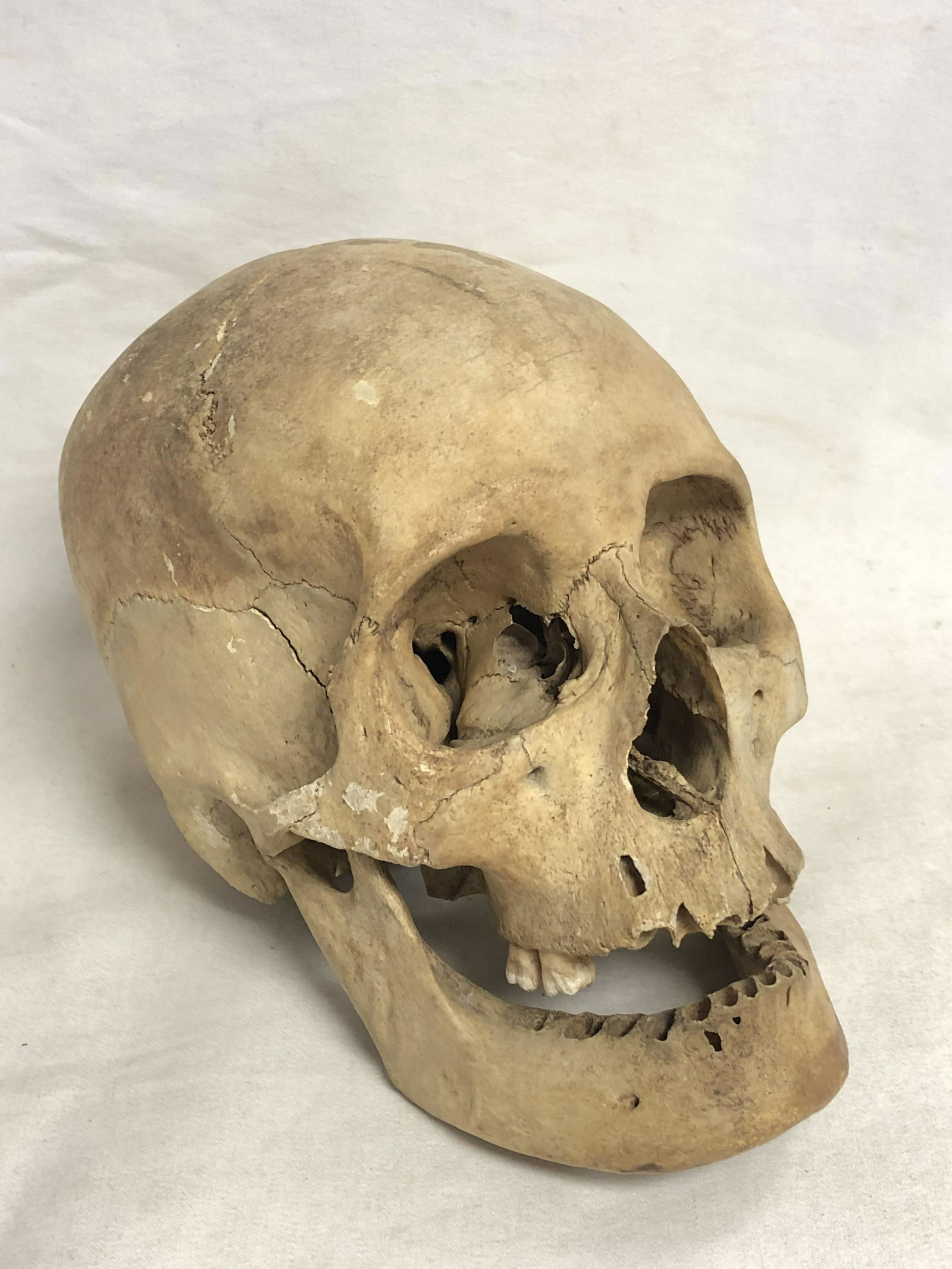 Atq Authentic Human Skull Model - From CAL University Physical Anthropologist Professors Collection (1 of 6)