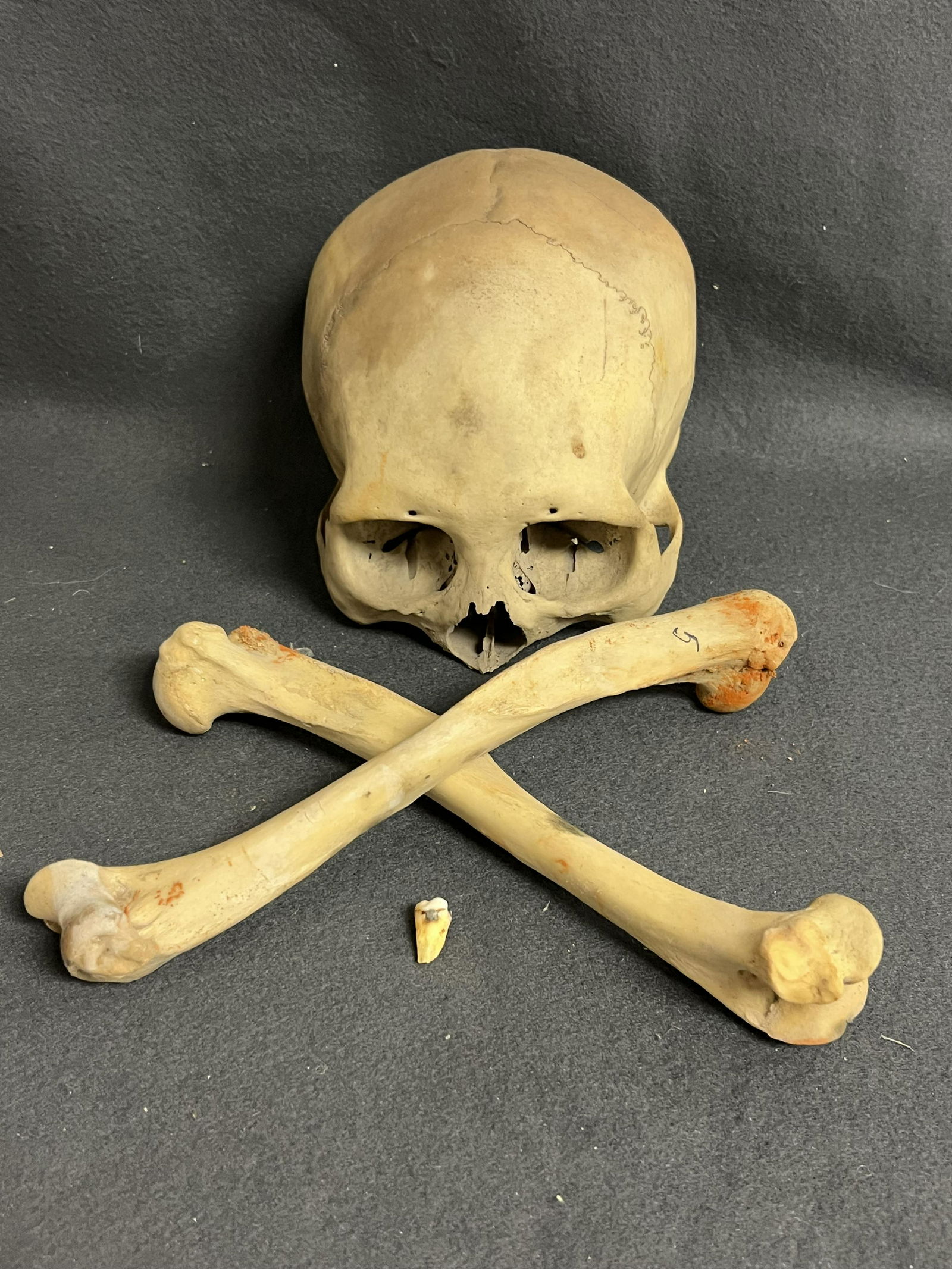 Authentic Human Skull & Bones For Teaching - Skull W/O Lower Jaw (All from Anthropology Professor (1 of 10)