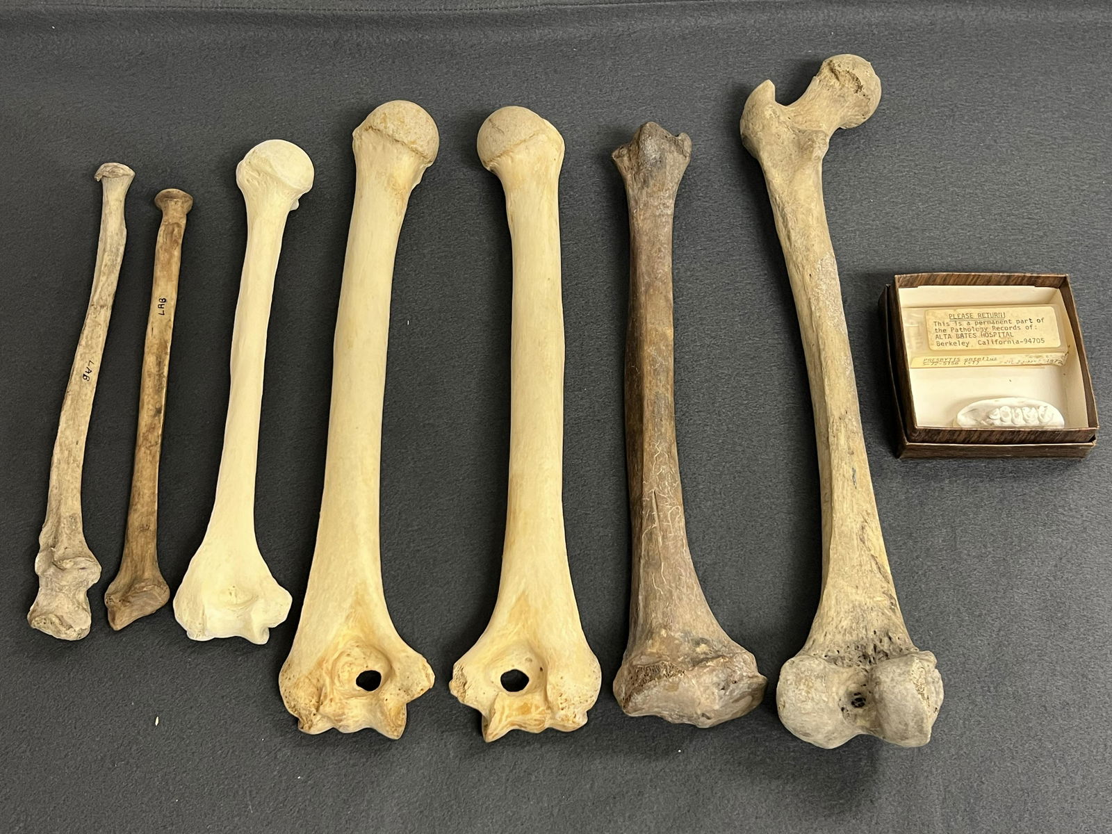 Lot Authentic Human Bones (Teaching Aide,Medical) - Asst Bones 11''- 16''+ (1)Slide from (1 of 5)