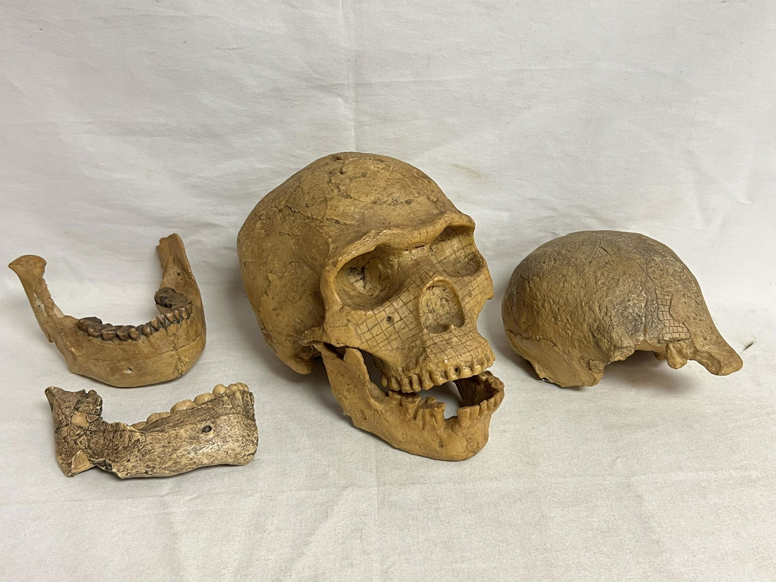 Medical Composite Human Skull + Jaw #d - From Anthropology Medical Professor Collection for Teaching (1 of 11)