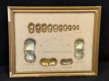 1940s Japanese Pearl Speciman Growth Chart with Pearls - Shadowbox Framed Pearl with Oyster Display
