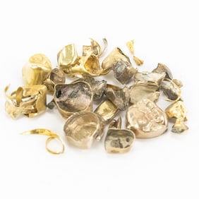 28 Grams of "Cleaned" Dental Gold