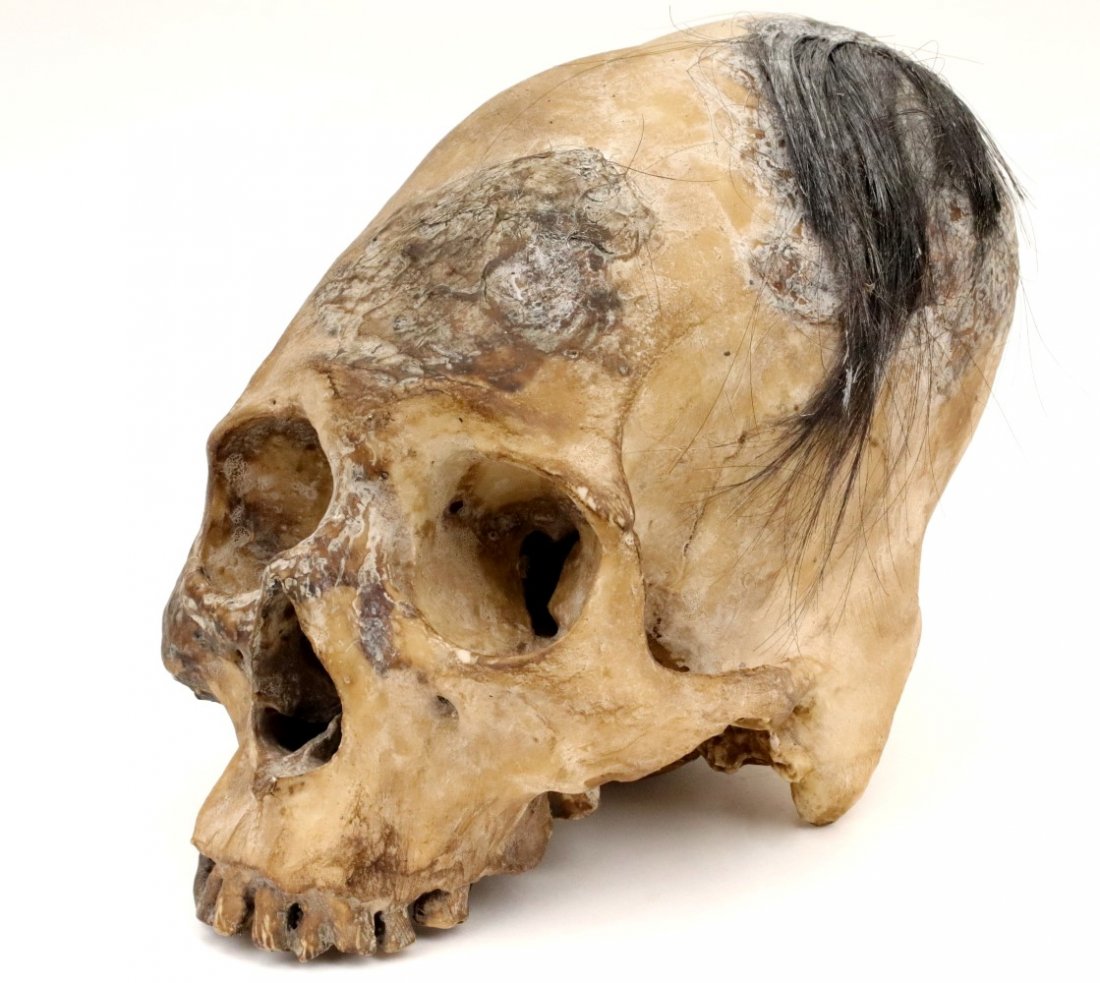 Impressive Museum Display of Indonesian Dayak: Impressive Museum Display of Indonesian Dayak Headhunter's Human Skull ~ Trophy Decoration. Detailed condition reports are not included in this catalog. For additional information, including condition