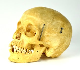 A Medical Study Articulated Human Skull