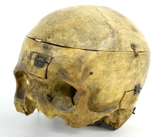 This is antique English 19th Century medical human skull.