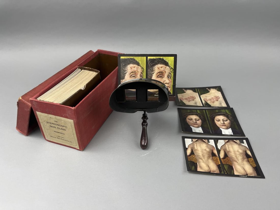 Rainforth Stereoscopic Skin Clinic Cards (1 of 7)