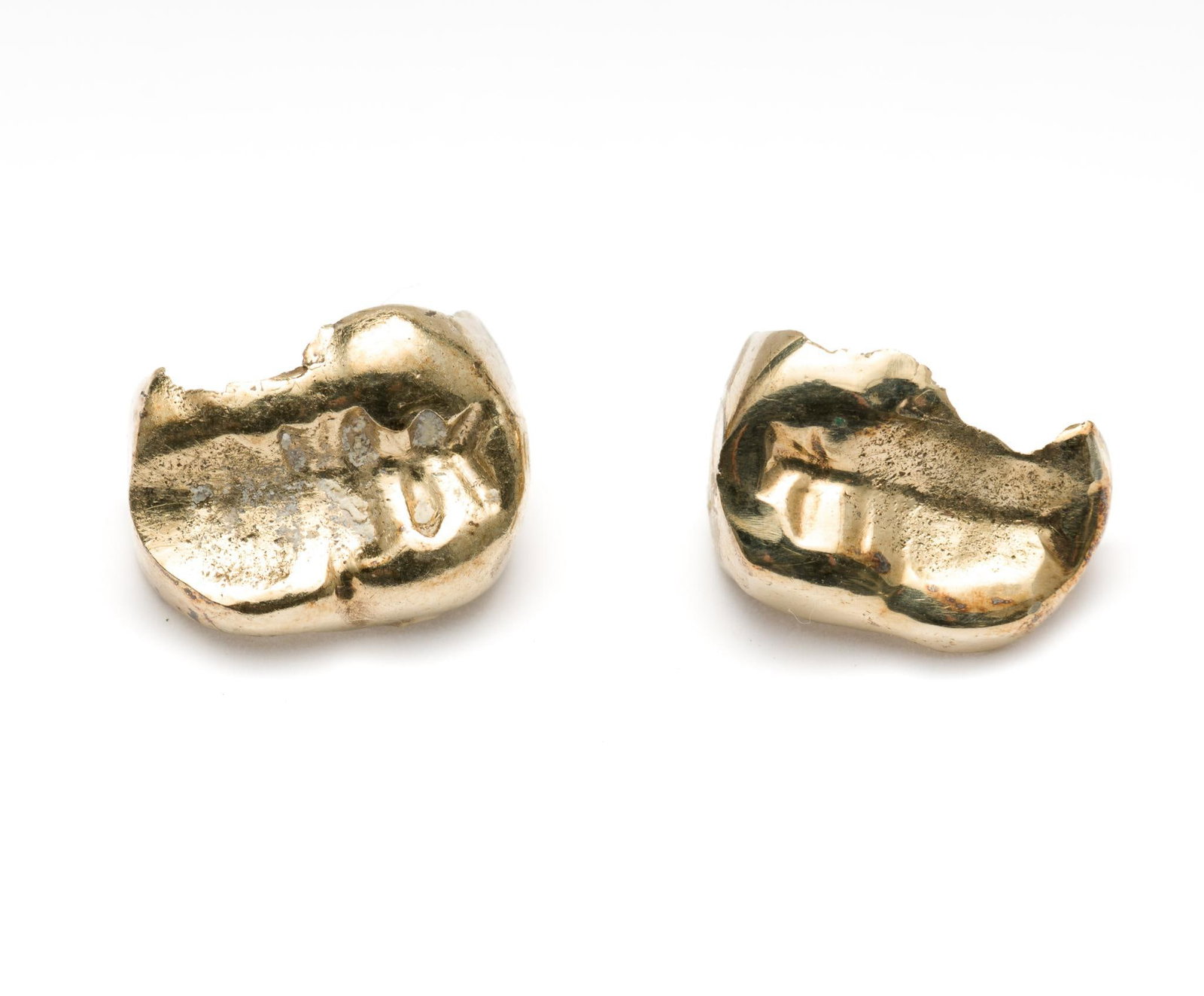 2 Pcs Dental Gold: 3.5 grams. MEG