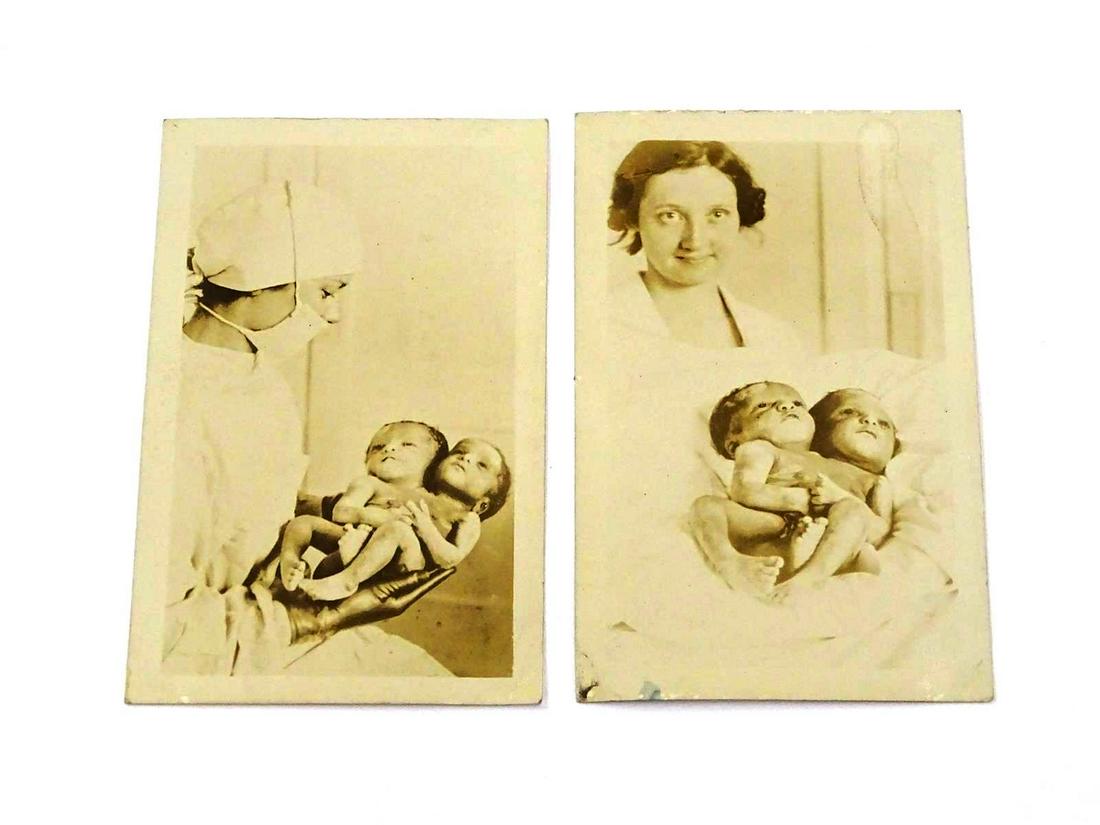 PAIR TWO-HEADED BABY REAL PHOTO POST CARDS (1 of 1)