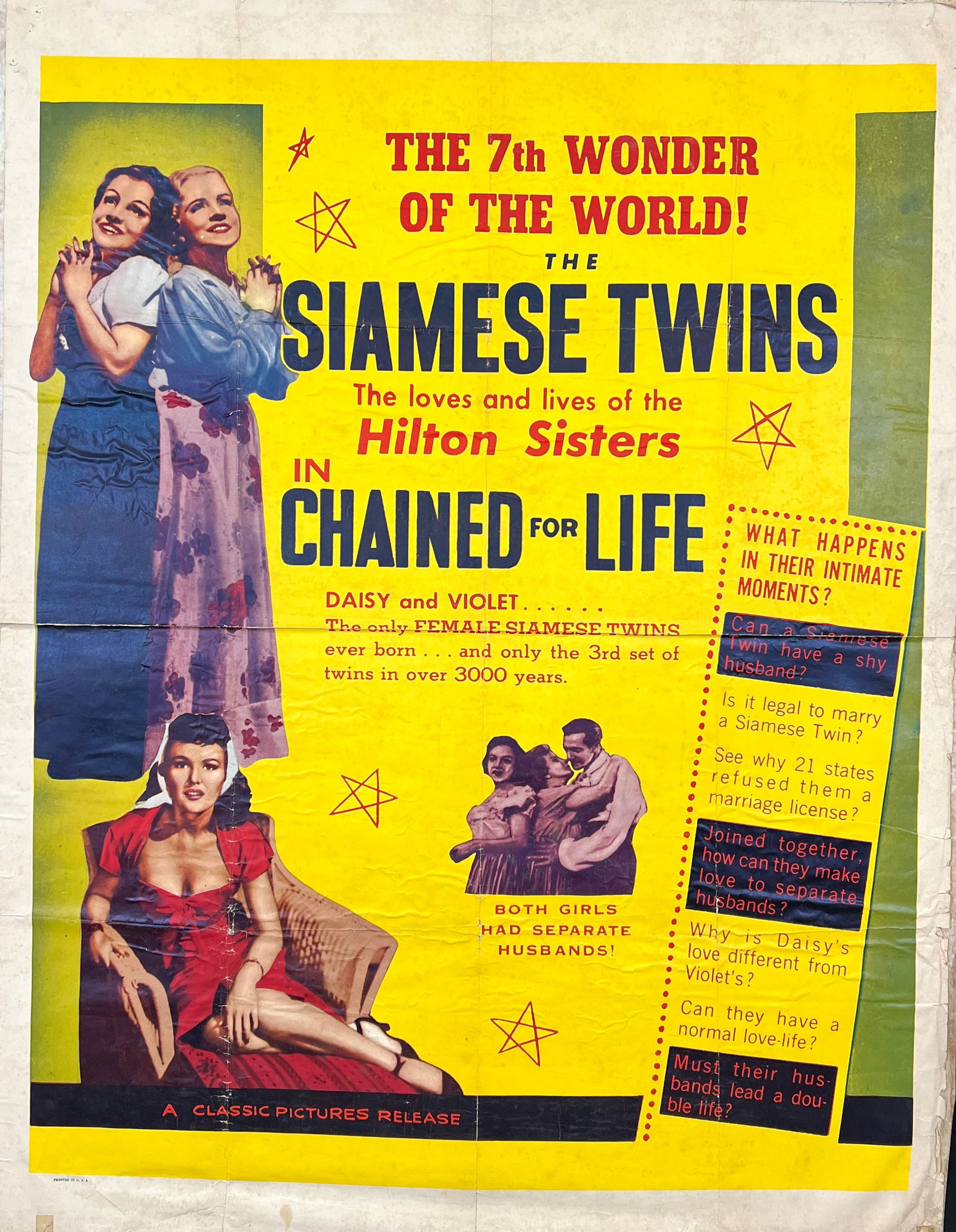 Chained For Life - The Siamese Twins - Hilton Sisters Poster (1 of 1)