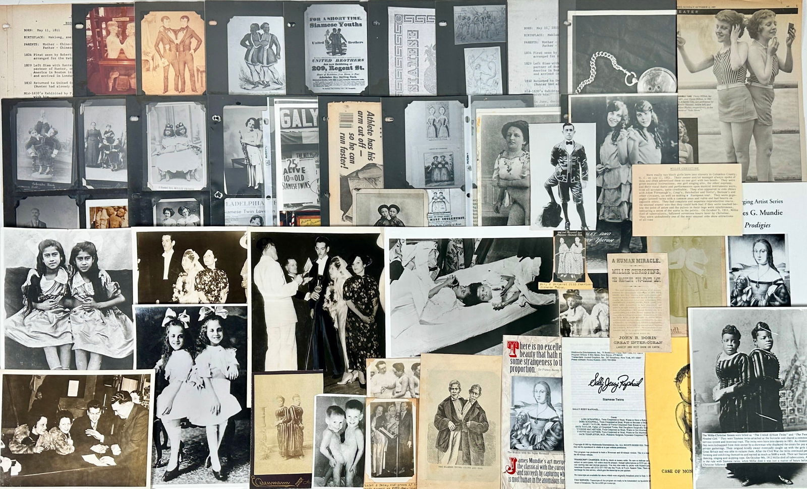 Siamese Twins Oddities Archive (1 of 5)