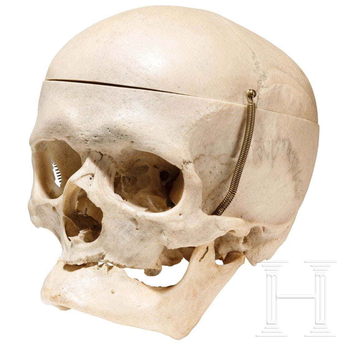 A human skull, medical preparation, 20th century (1 of 3)
