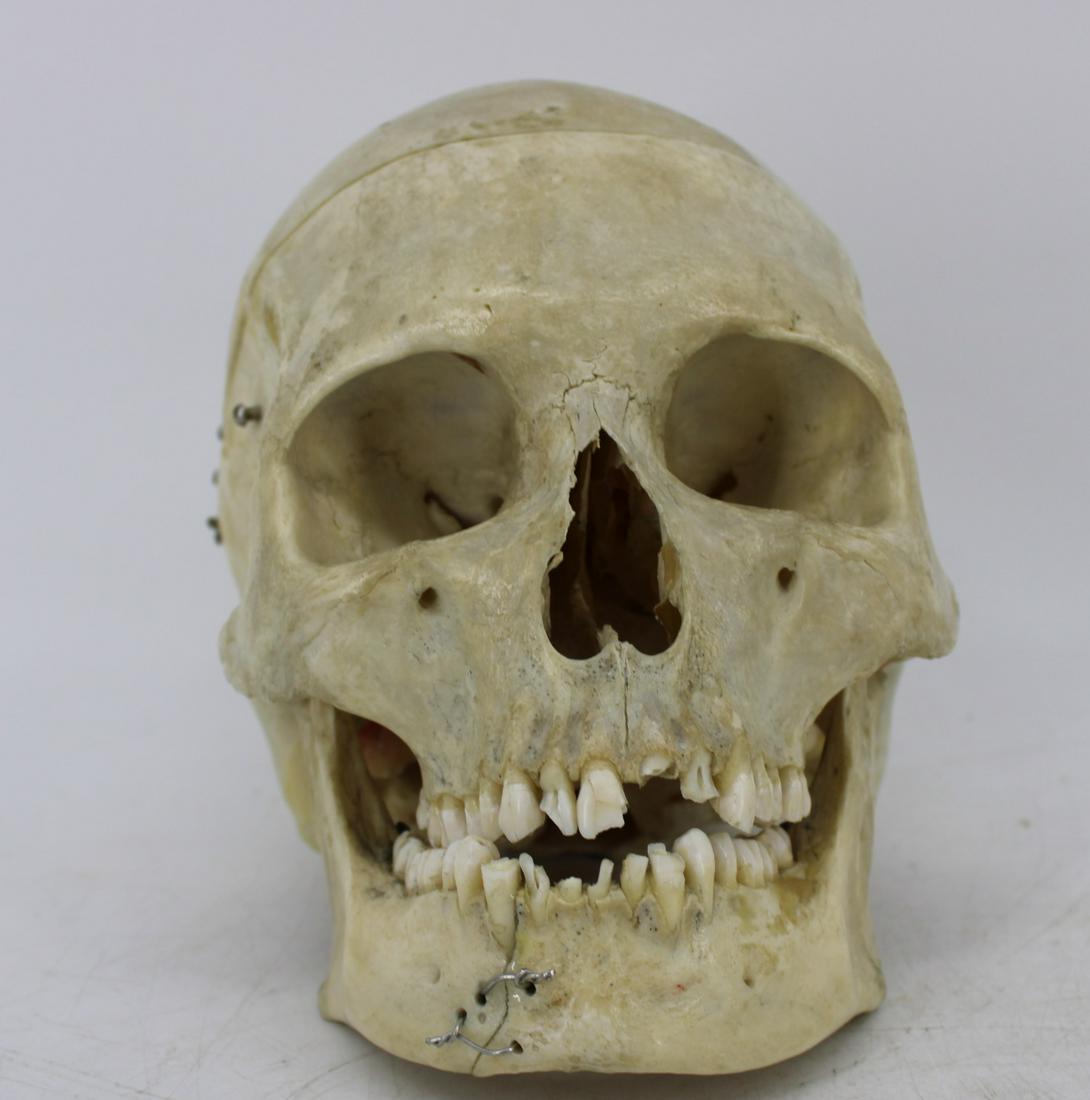 Antique Medical Human Skull. (1 of 5)